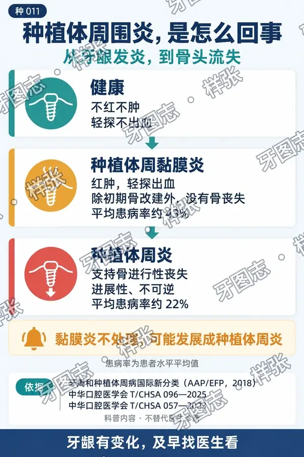 朋友圈信息图样张:种植体周围炎,是怎么回事